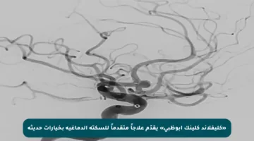 «كليفلاند كلينك أبوظبي» يقدّم علاجاً متقدماً للسكتة الدماغية بخيارات حديثة